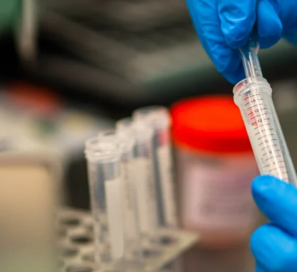 Conoce la variedad en la calidad del semen